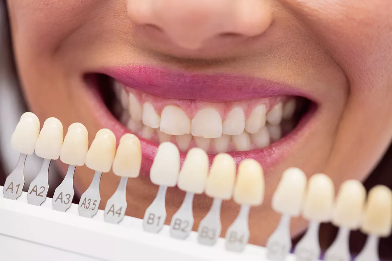 dentist-examining-female-patient-with-teeth-shades