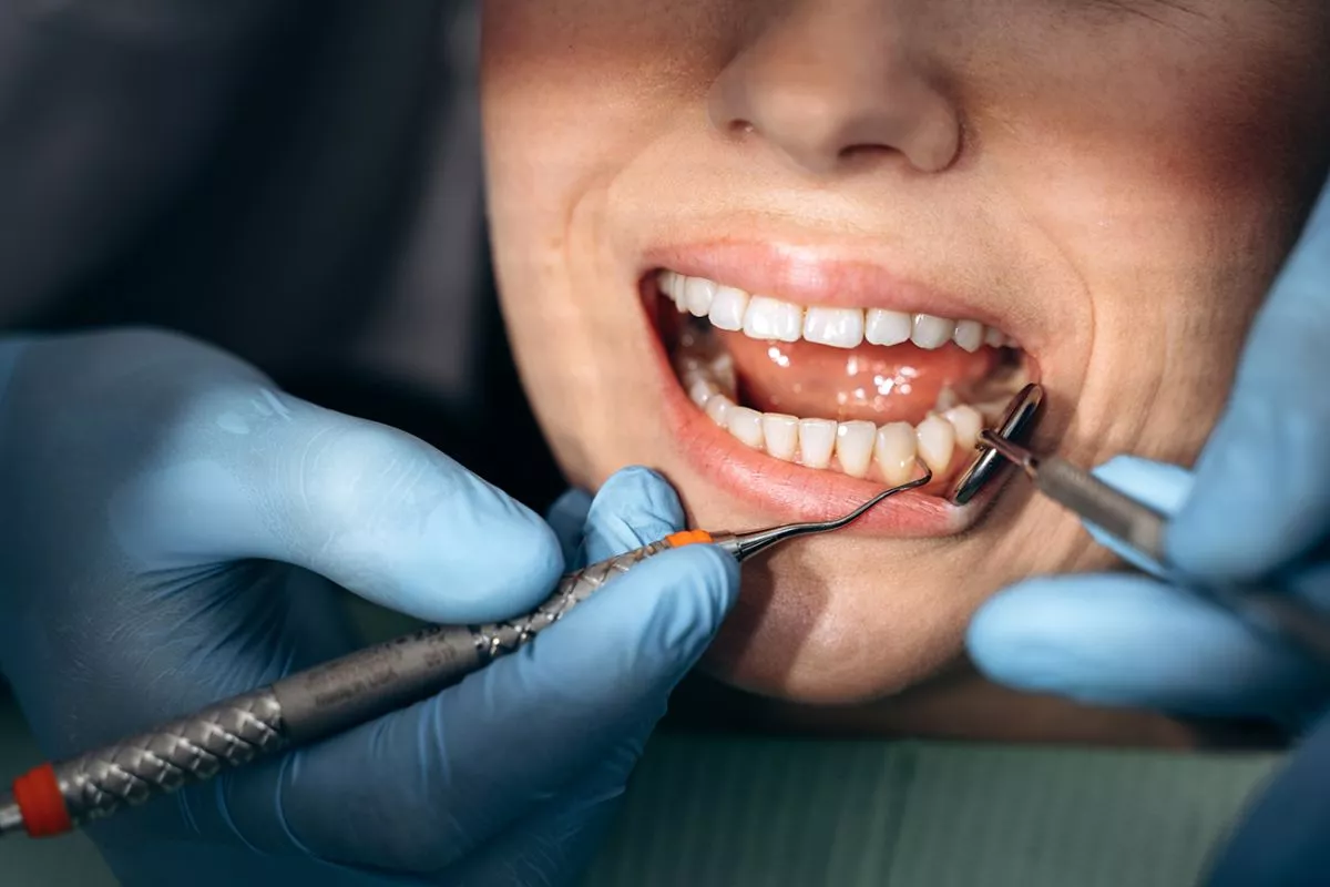 vista-ravvicinata-un-medico-cura-i-denti-di-una-persona-il-dentista-esamina-i-denti-del-paziente-con-l-aiuto-di-strumenti-di-lavoro-1